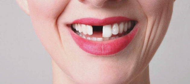 1718269687697974.jpg R-C (1).jpg