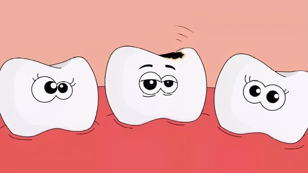 1719363444928053.jpg 儿童蛀牙1.jpg