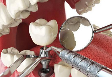 1719624627614614.png 4.png