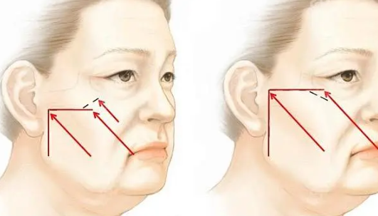 1720489075454461.png 1.png