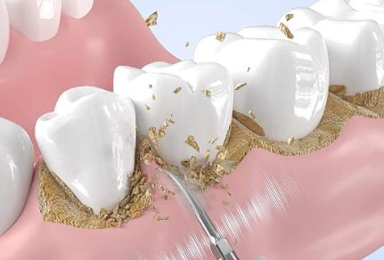 1720834436153499.png 4.png