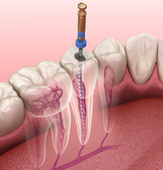 1721093814117530.png 3.png