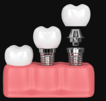 1722478285938423.png 3.png