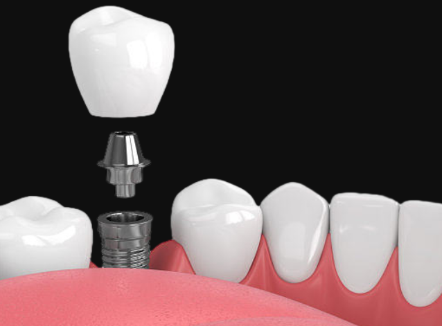 1722912167751798.png 1.png