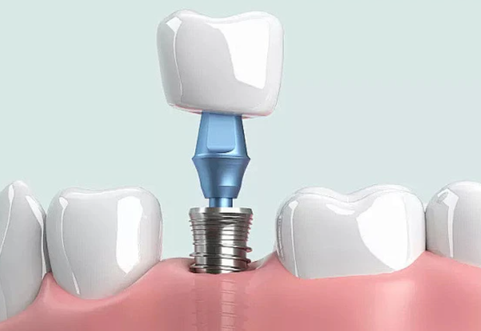 1723255625300204.png 2.png