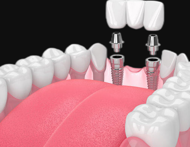 1723340354540406.png 1.png