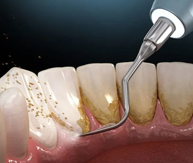 1723603266936288.png 1.png