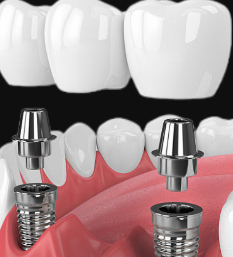 1723777198829383.png 1.png