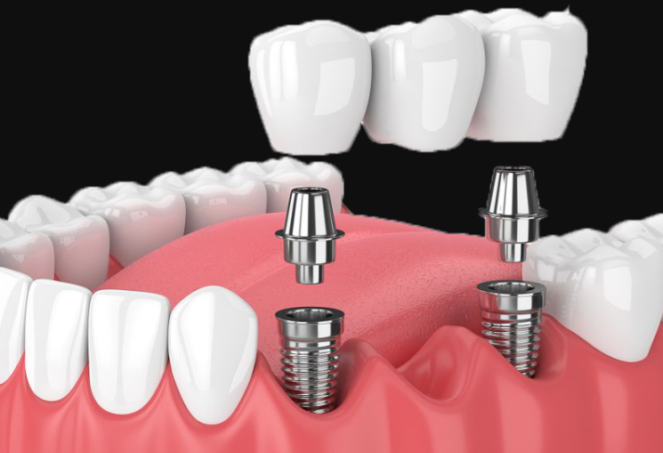 1724222227624111.png 1.png