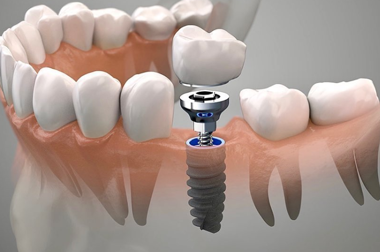 1724291615982763.png 1.png