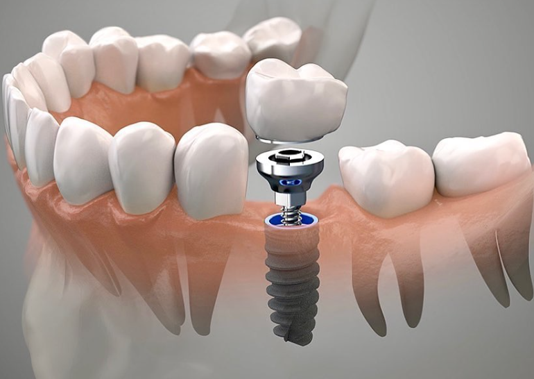 1725245912936635.png 1.png