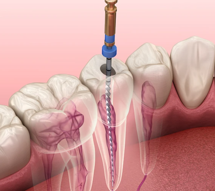 1725417594408343.png 1.png