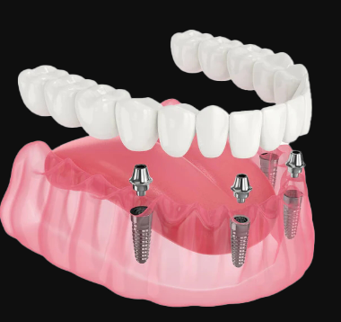 1726366923165982.png 1.png