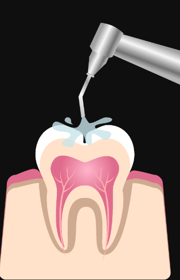 1727058157882641.png 1.png