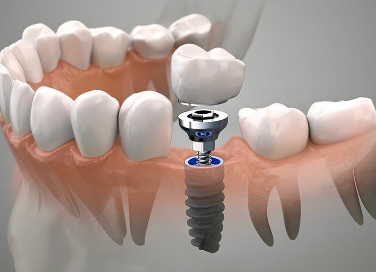 1727141784668679.png 1.png